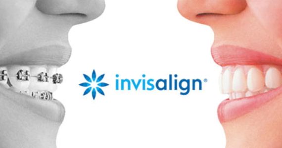 hyattsville Dentist Invisalign hyattsville